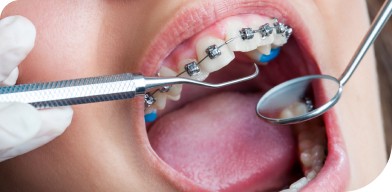 Dr Boison Quentin orthodontiste idees recues Labenne