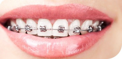 Dr Boison orthodontiste urgences orthodontiques Labenne