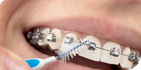 Dr Quentin Boison brossettes inter dentaires Labenne