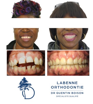 Orthodontie cabinet Labenne Tarnos orthodontiste Dr Quentin Boison