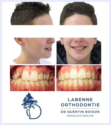 Orthodontie cabinet Labenne orthodontiste Dr Quentin Boison
