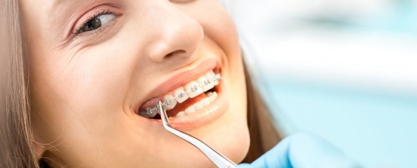 Orthodontiste Dr Quentin Boison controle soins