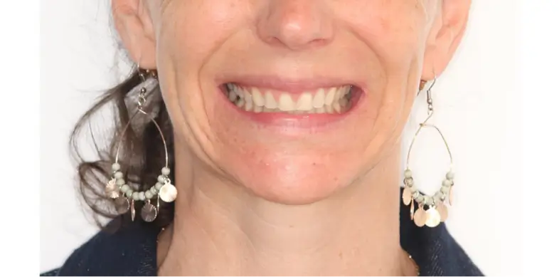 CLASSE II SUBDIVISION COMPLÈTE + DÉVIATION DES MILIEUX