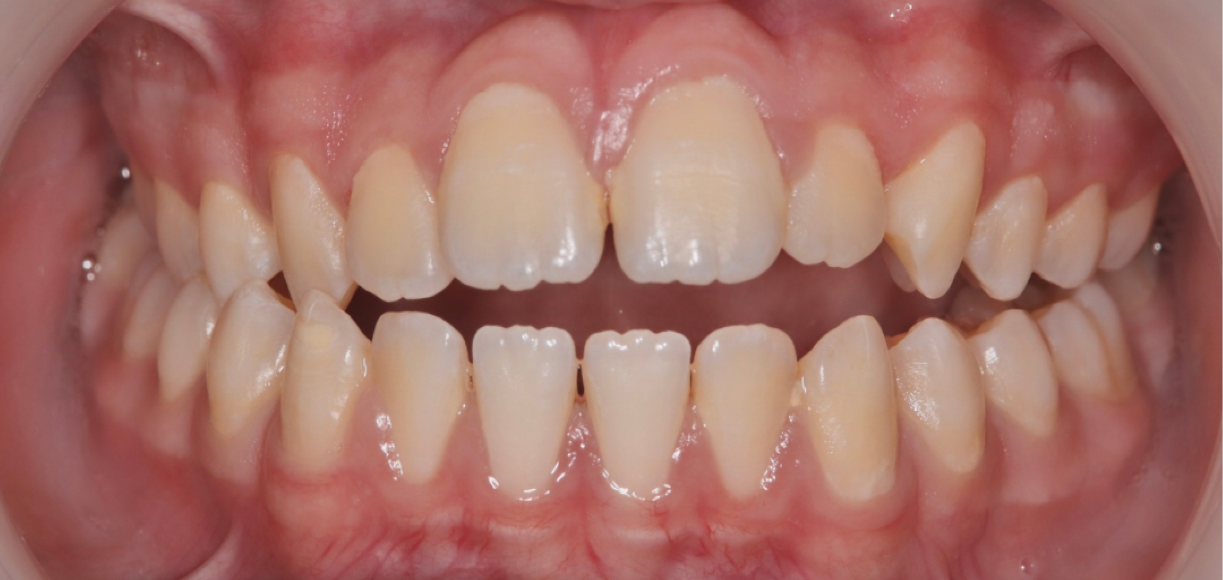 Exemples de cas traités par le Dr Quentin Boison