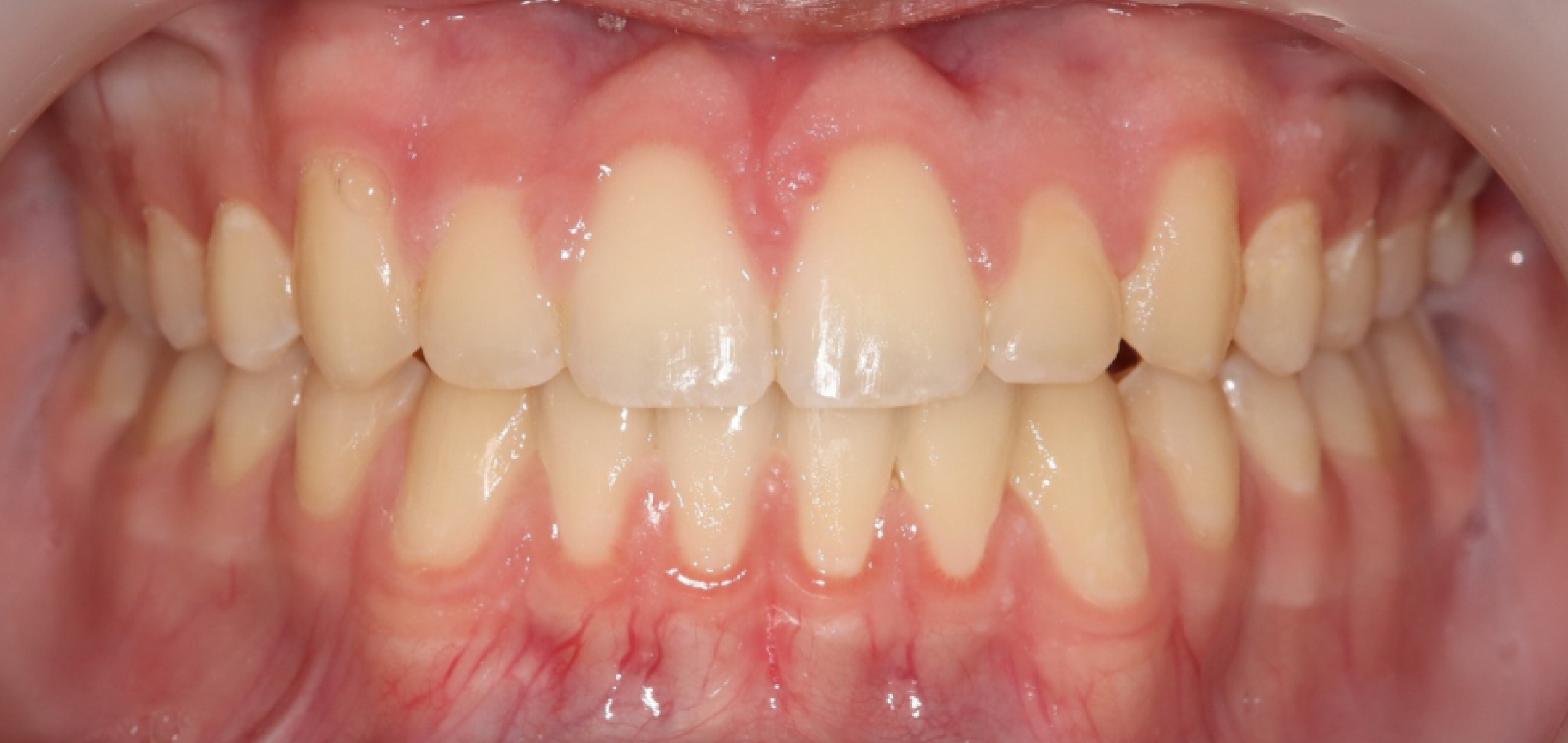 Exemples de cas traités par le Dr Quentin Boison