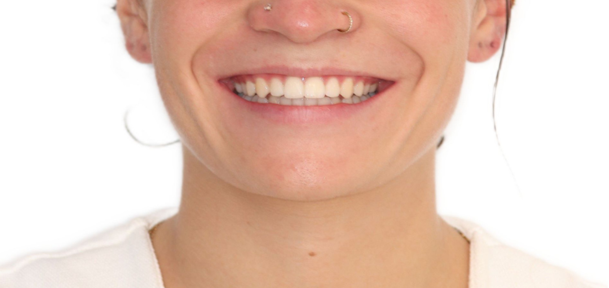 Exemples de cas traités par le Dr Quentin Boison