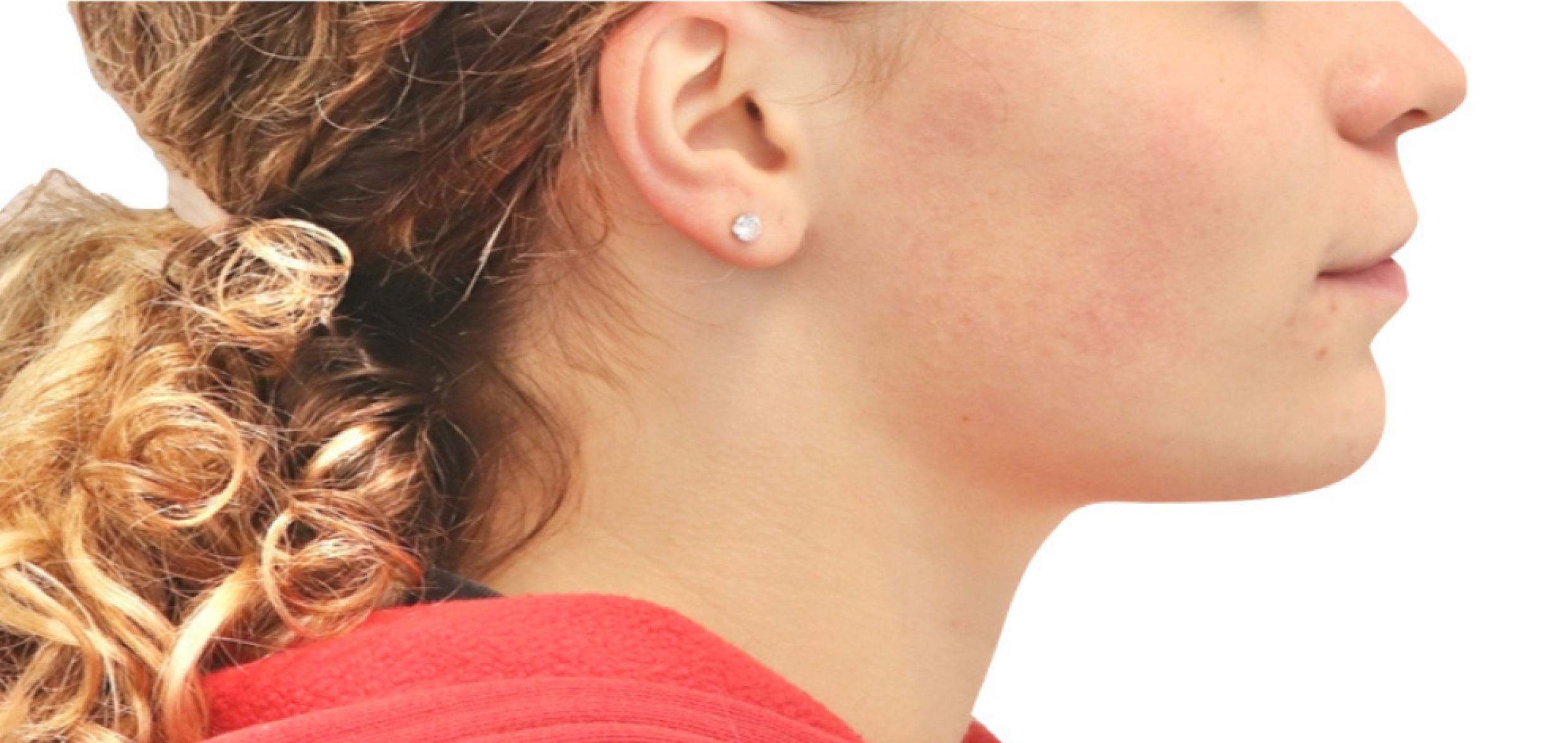 Exemples de cas traités par le Dr Quentin Boison