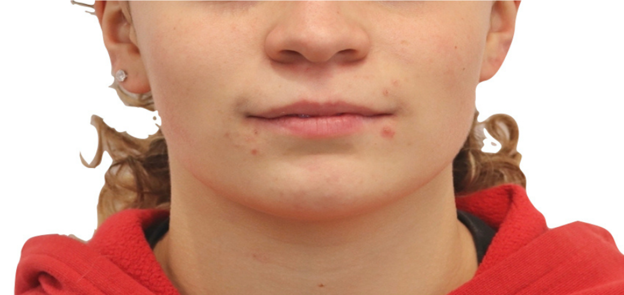 Exemples de cas traités par le Dr Quentin Boison