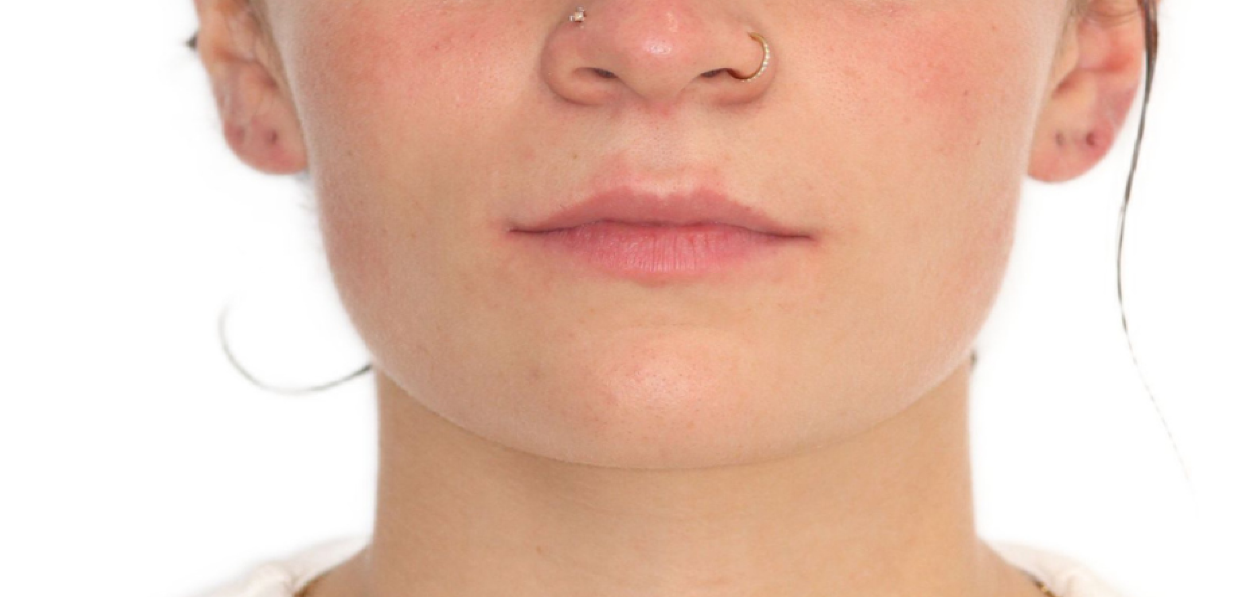 Exemples de cas traités par le Dr Quentin Boison