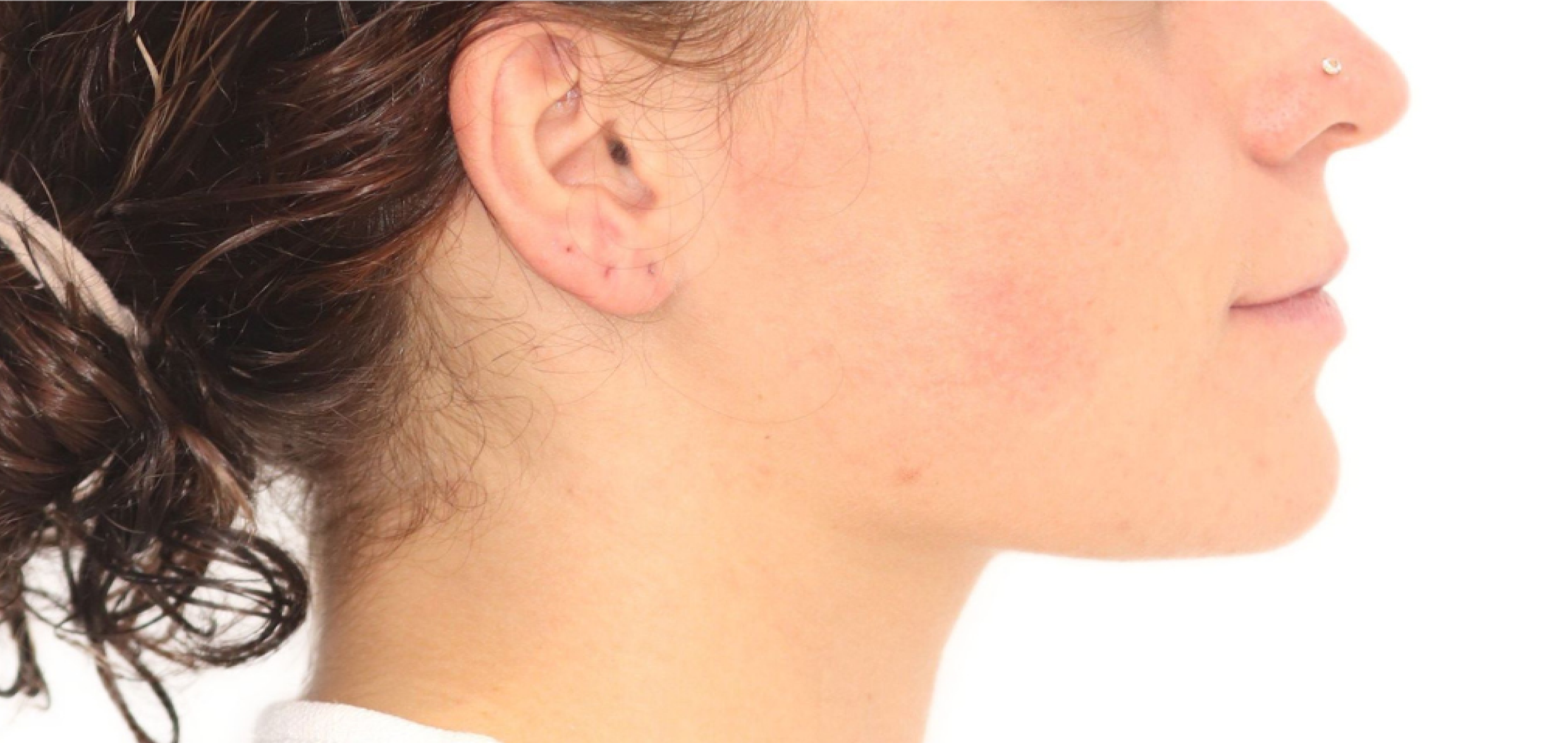 Exemples de cas traités par le Dr Quentin Boison