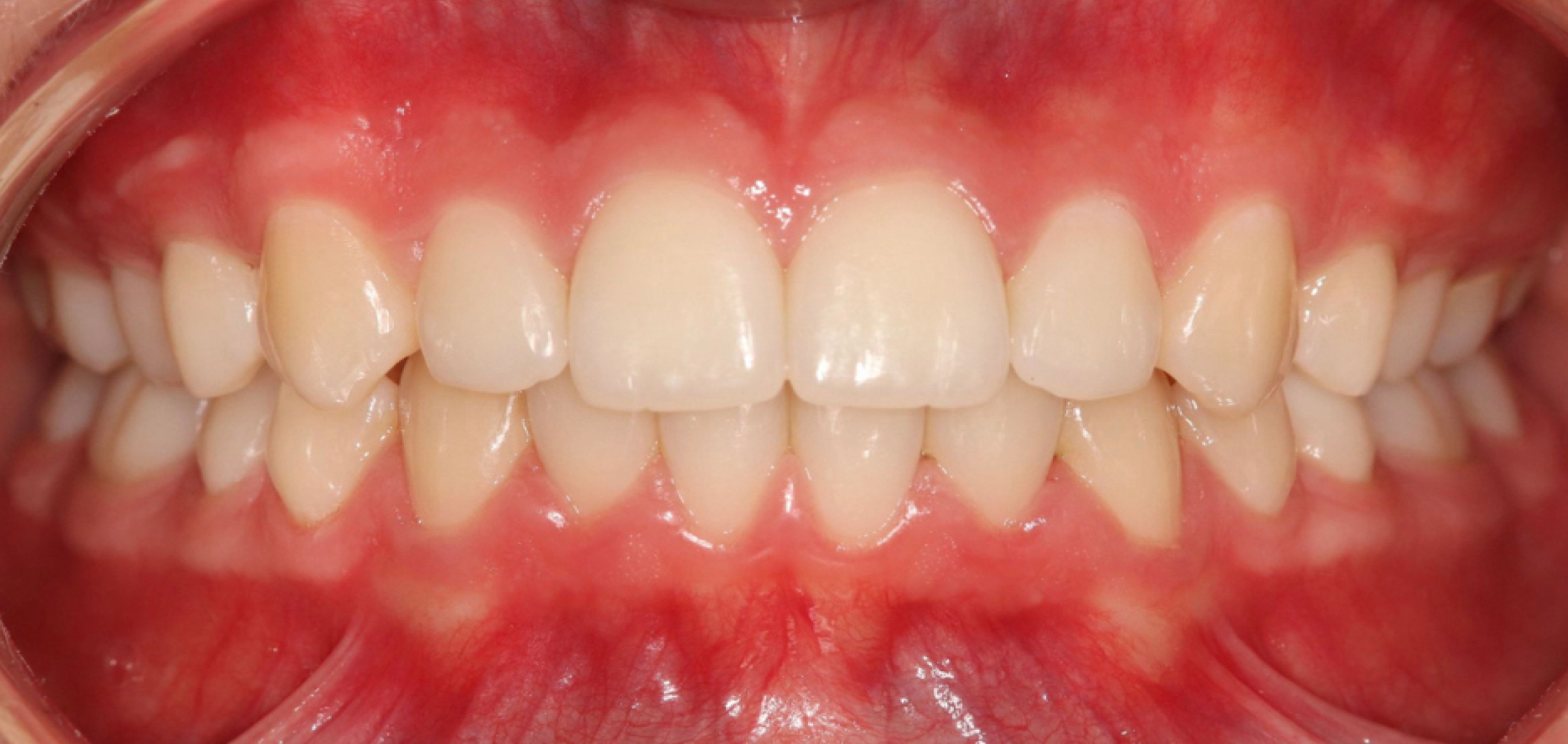 Exemples de cas traités par le Dr Quentin Boison