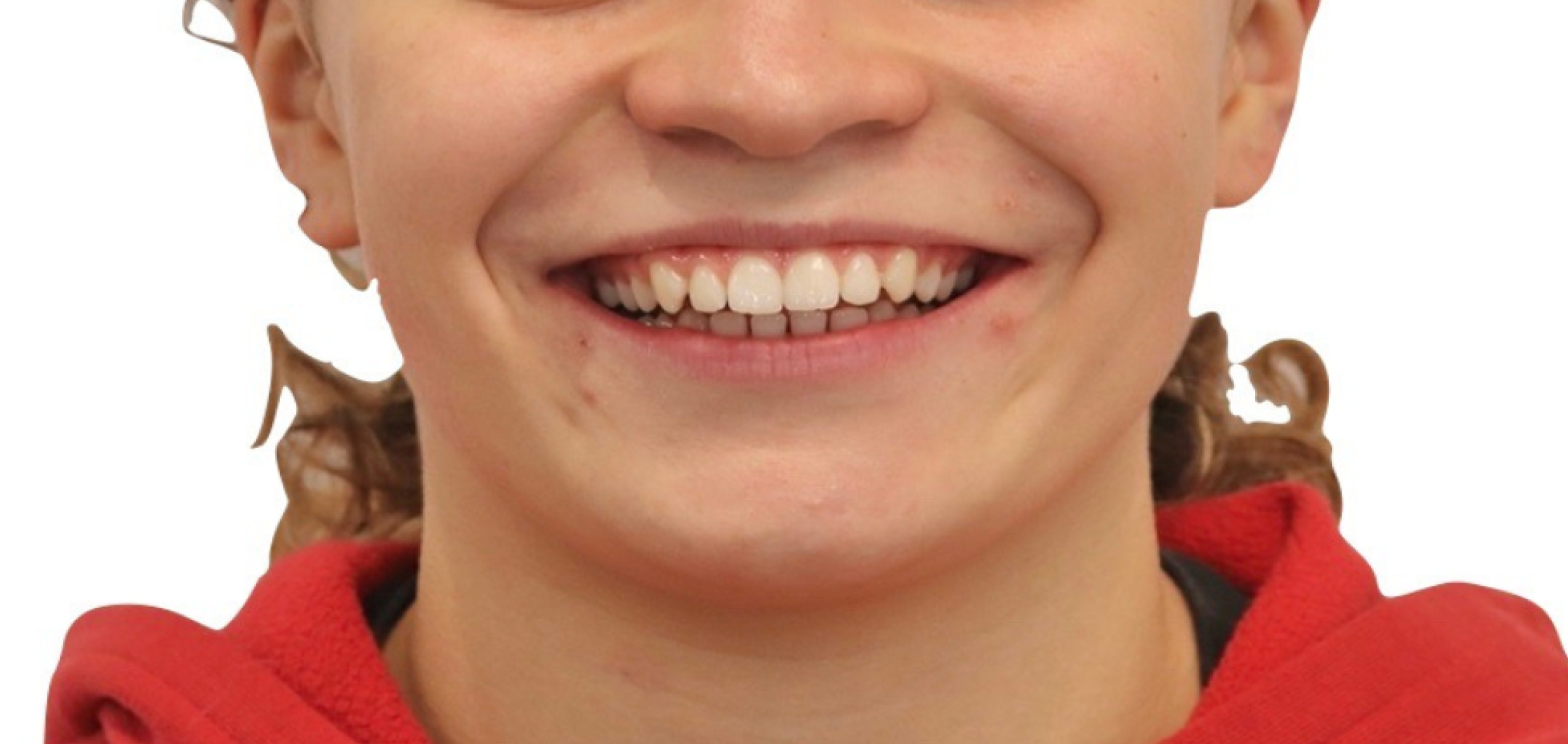 Exemples de cas traités par le Dr Quentin Boison