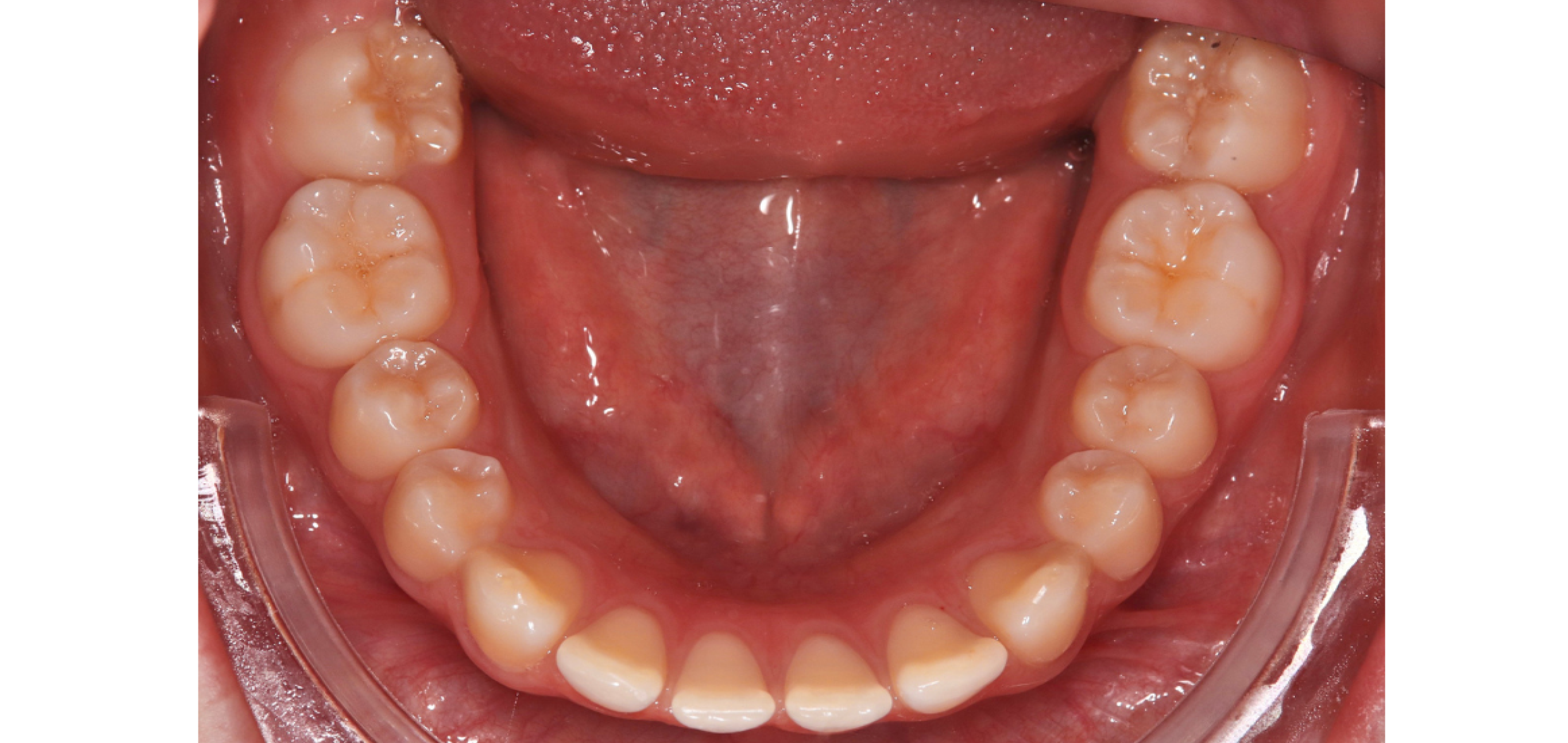 Exemples de cas traités par le Dr Quentin Boison