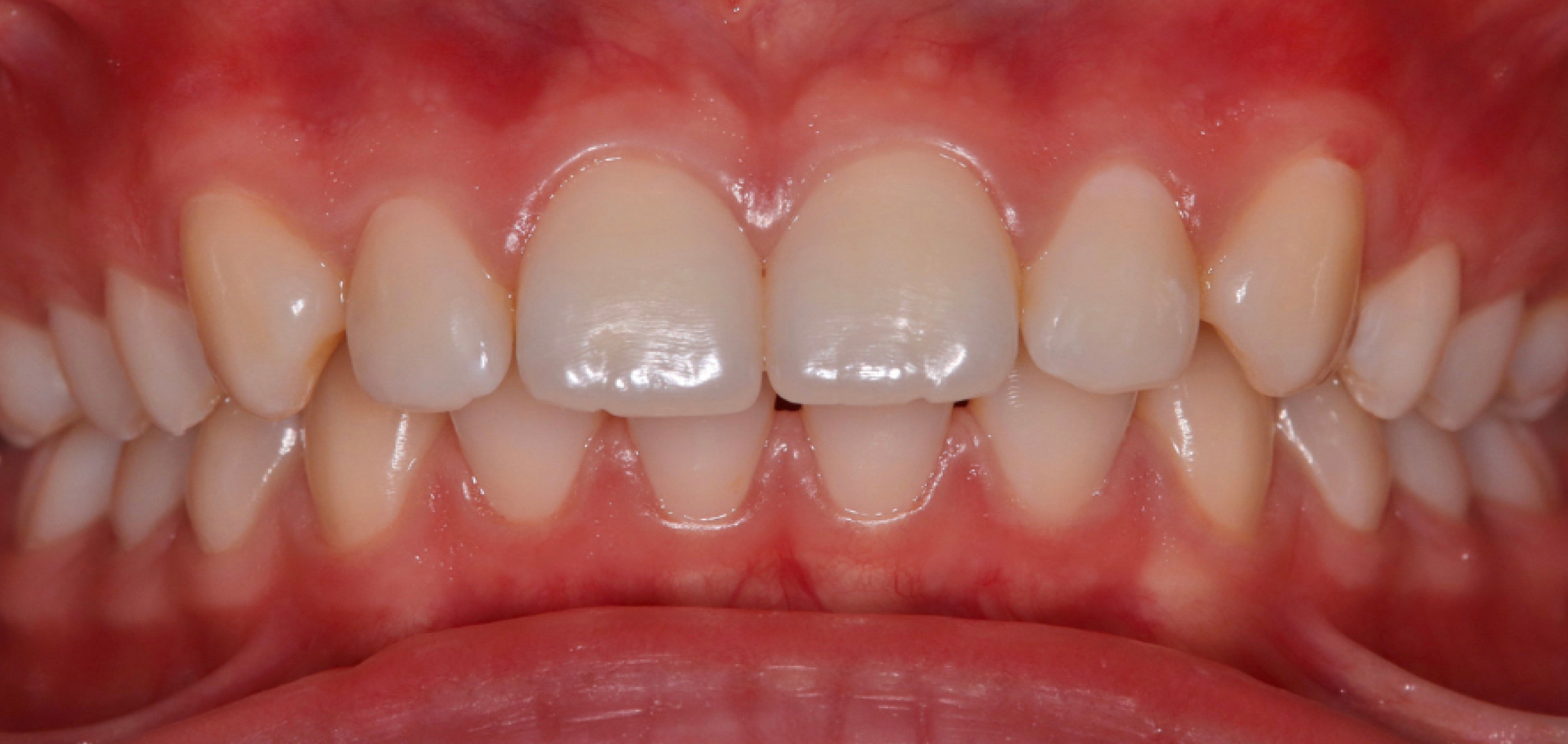 Exemples de cas traités par le Dr Quentin Boison