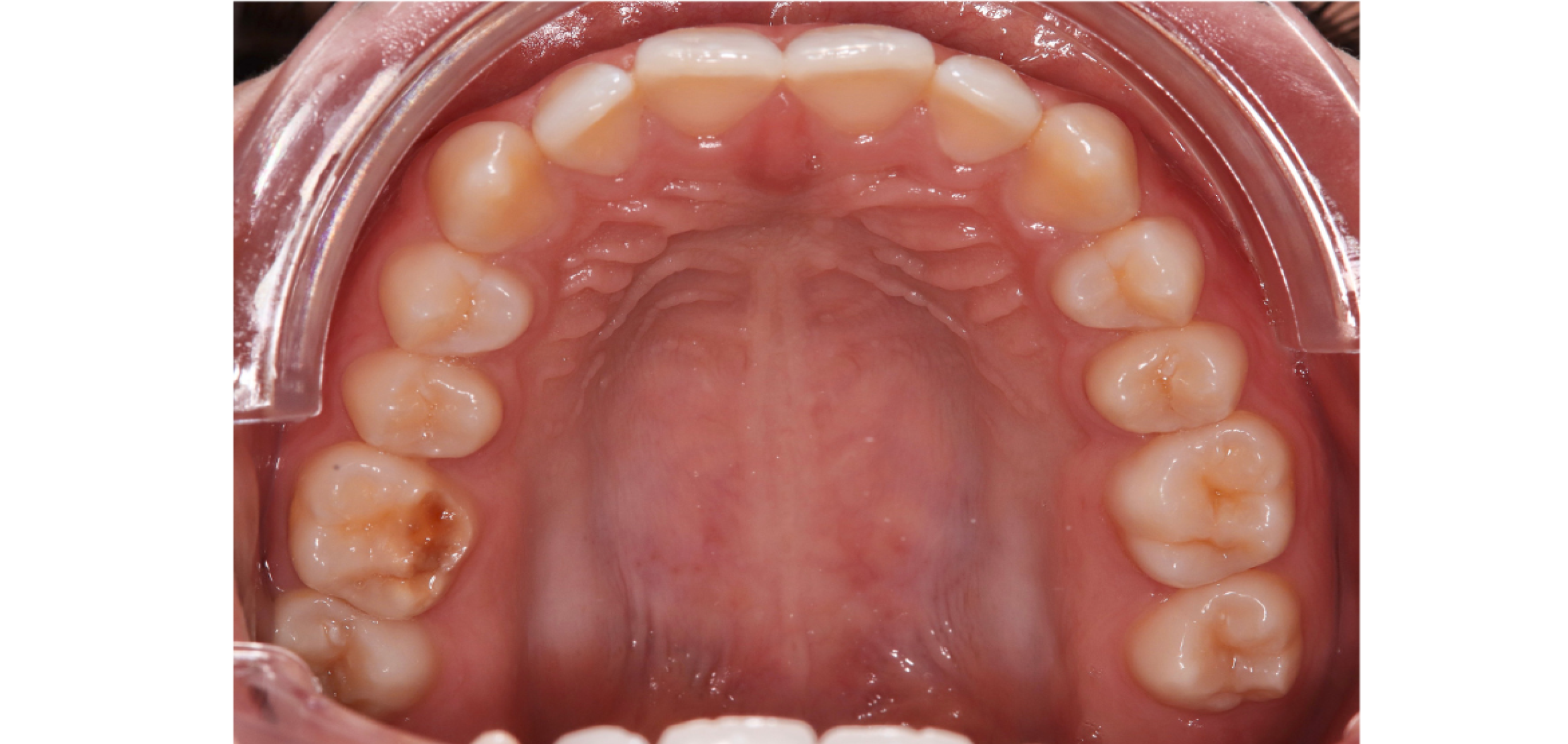 Exemples de cas traités par le Dr Quentin Boison