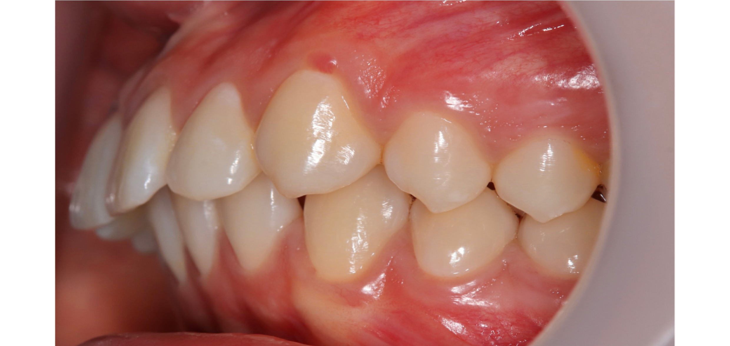 Exemples de cas traités par le Dr Quentin Boison