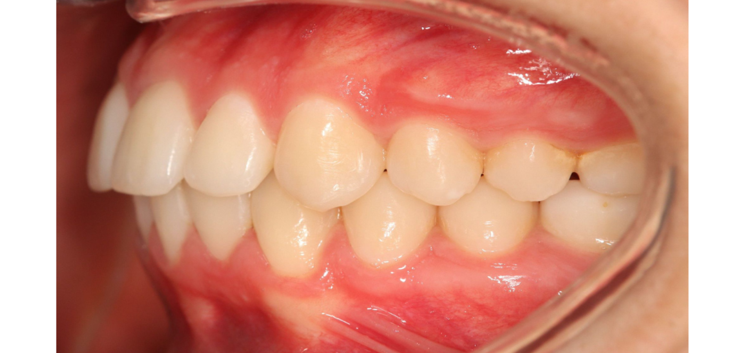 Exemples de cas traités par le Dr Quentin Boison