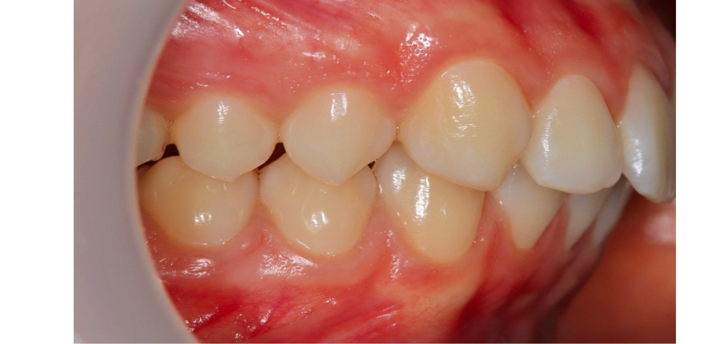 Exemples de cas traités par le Dr Quentin Boison