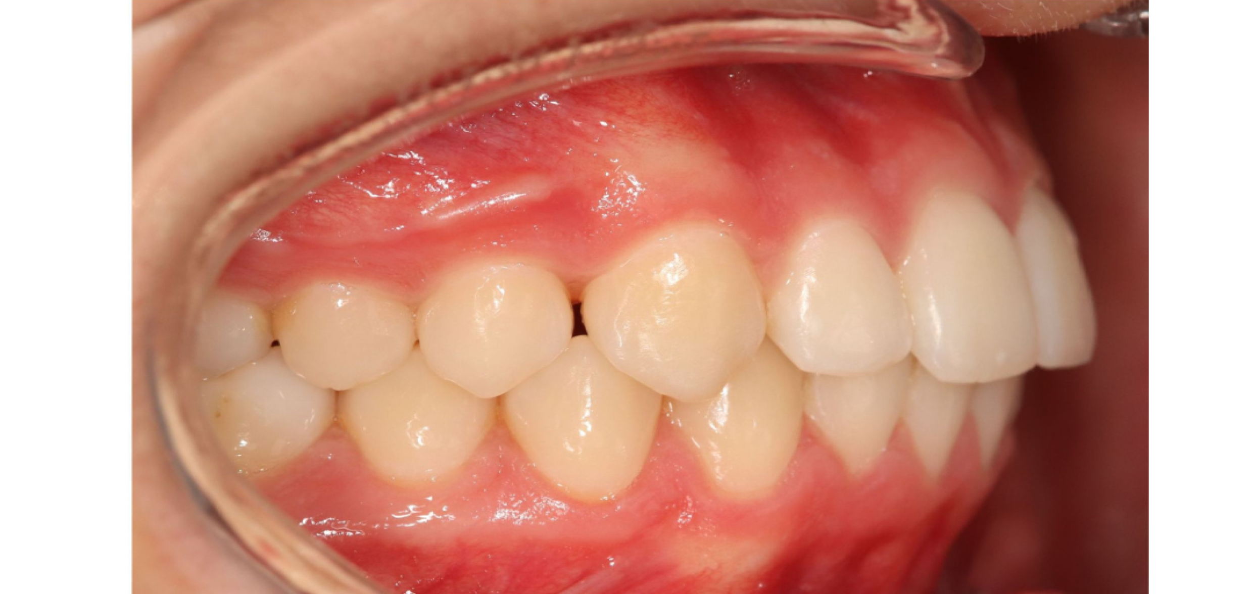 Exemples de cas traités par le Dr Quentin Boison