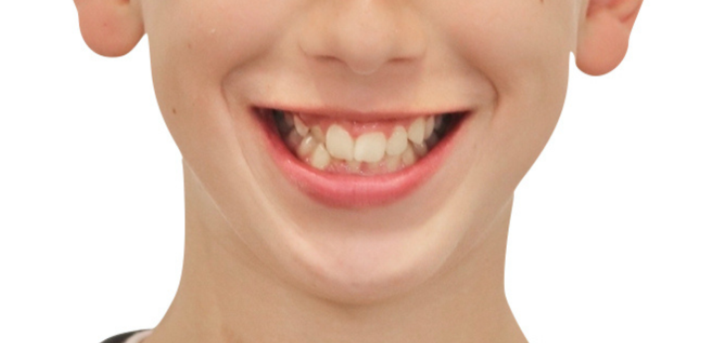 Exemples de cas traités par le Dr Quentin Boison