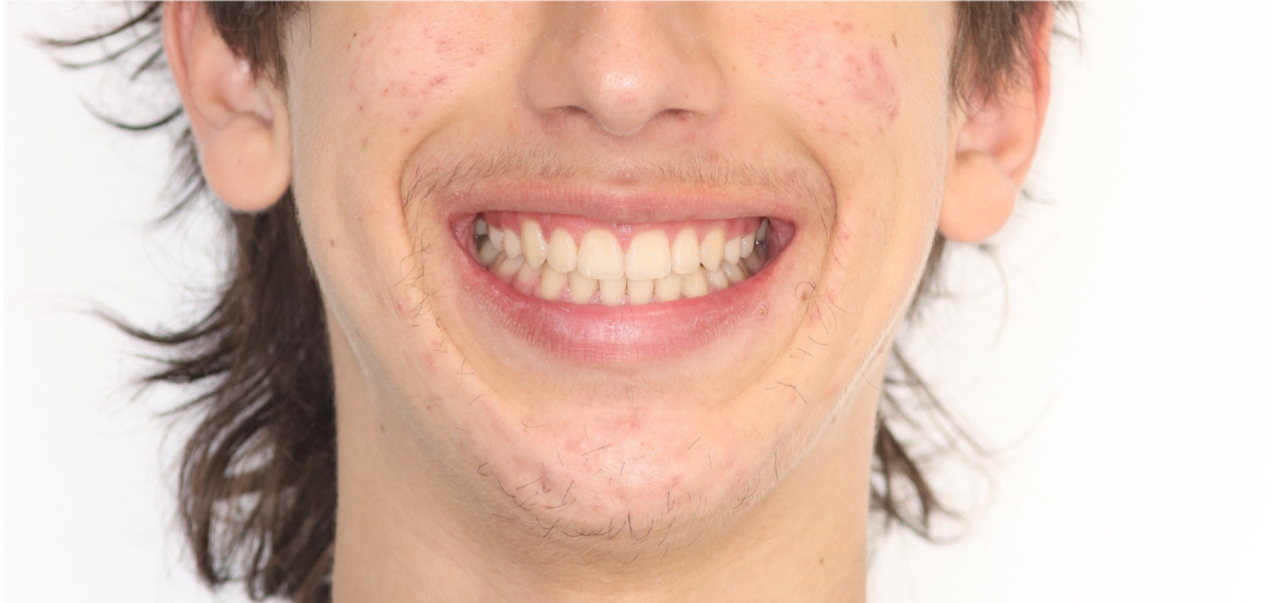 Exemples de cas traités par le Dr Quentin Boison