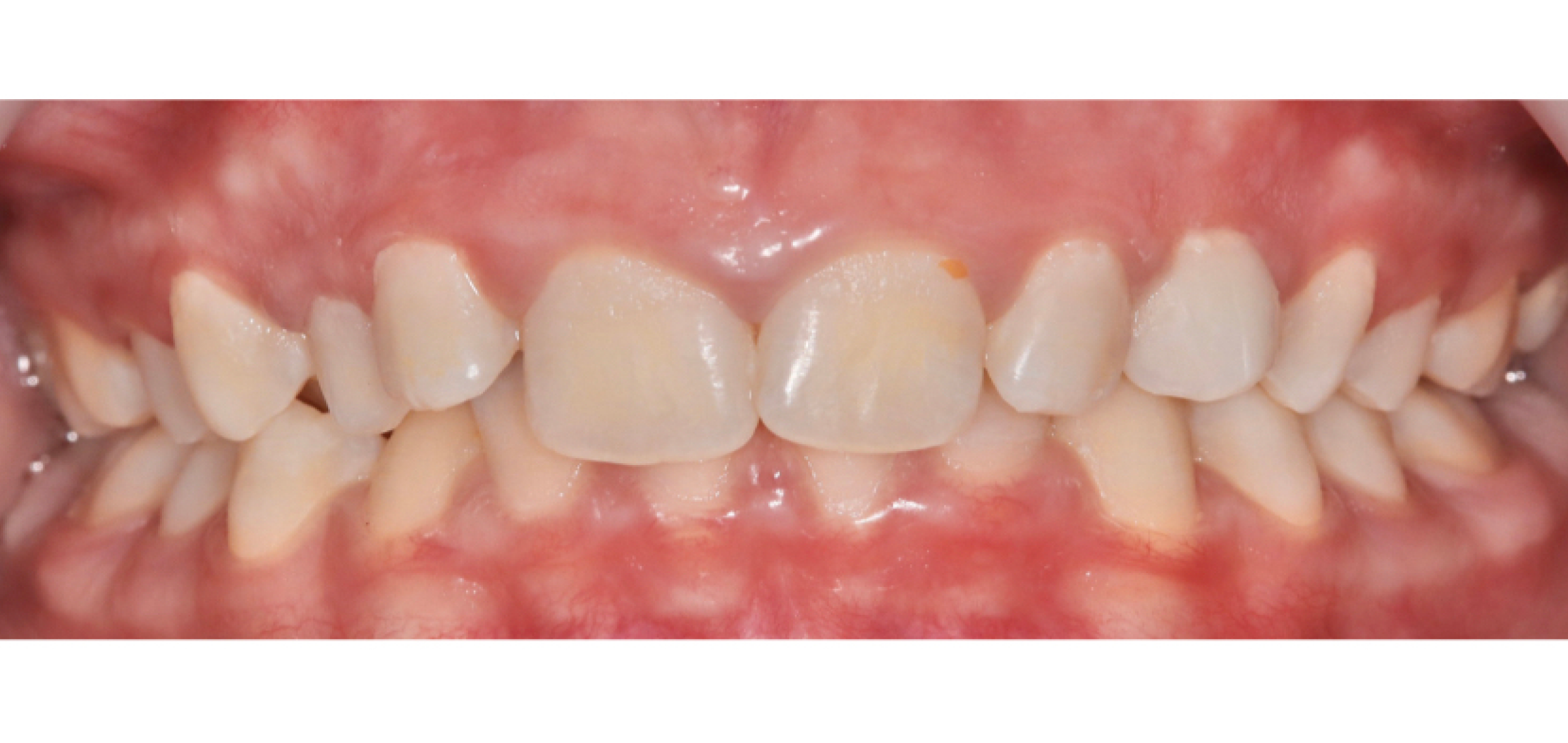 Exemples de cas traités par le Dr Quentin Boison