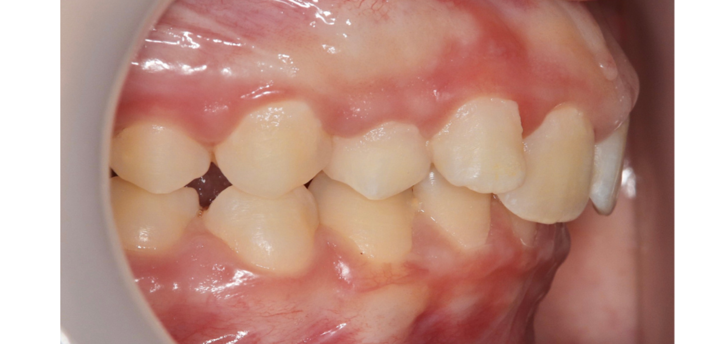 Exemples de cas traités par le Dr Quentin Boison