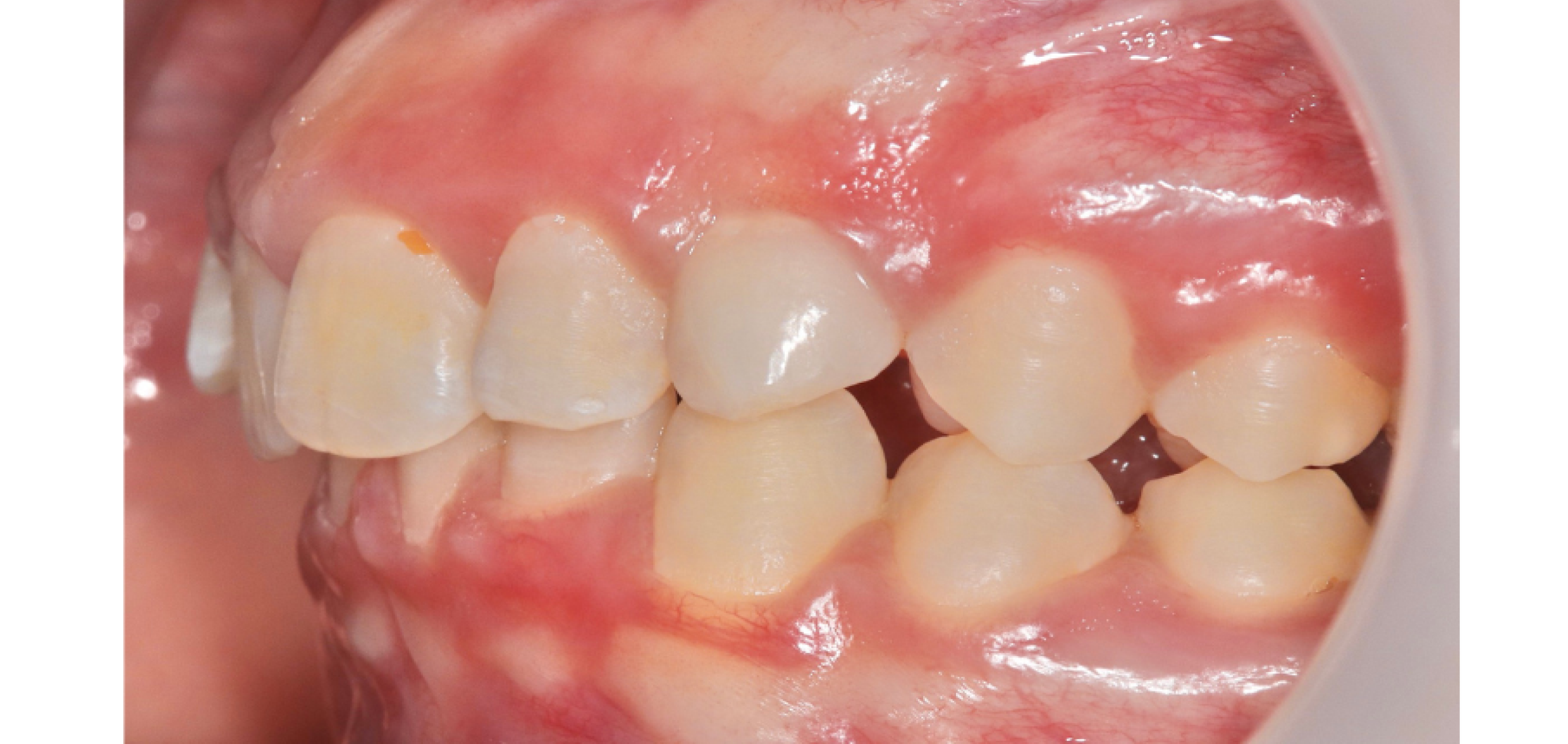 Exemples de cas traités par le Dr Quentin Boison