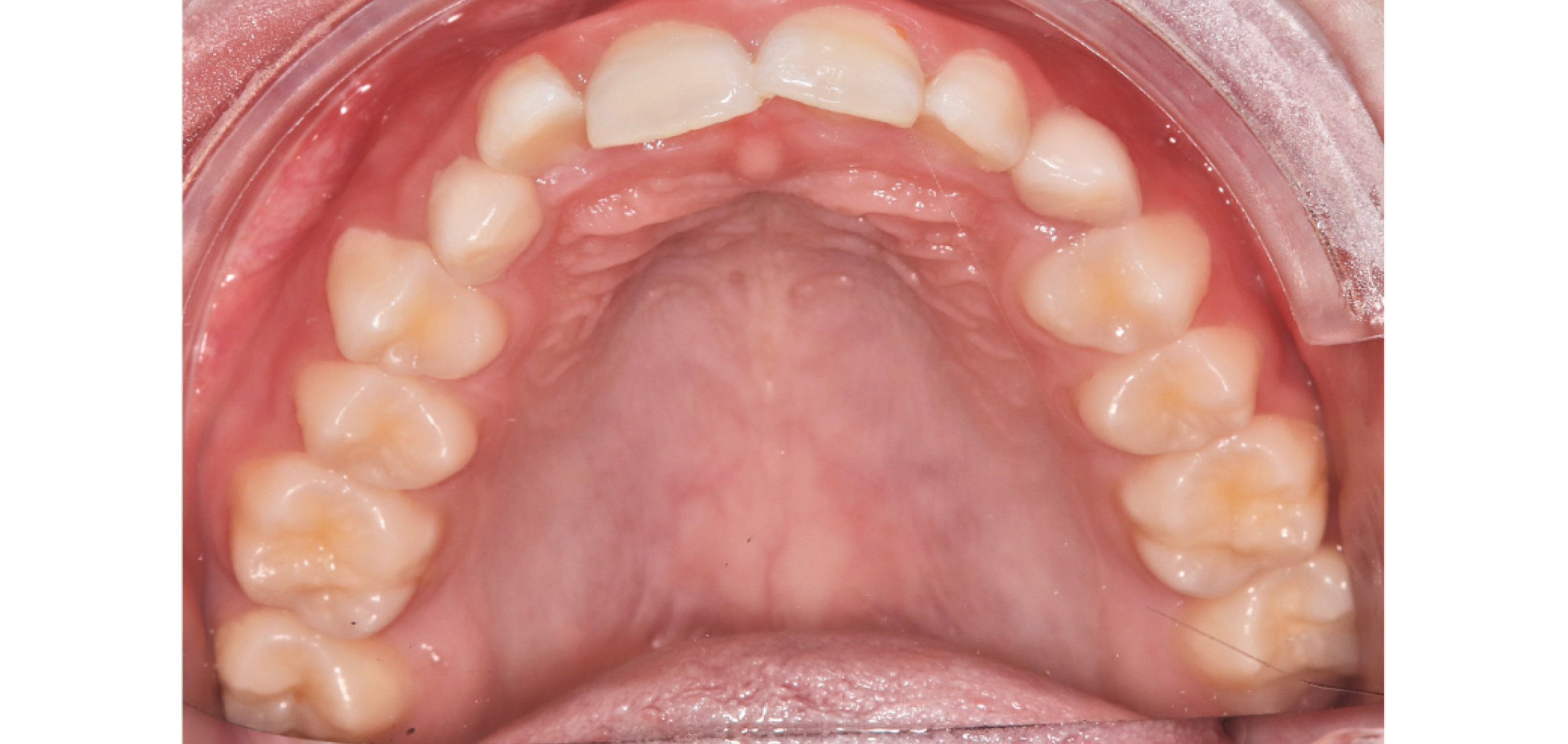 Exemples de cas traités par le Dr Quentin Boison