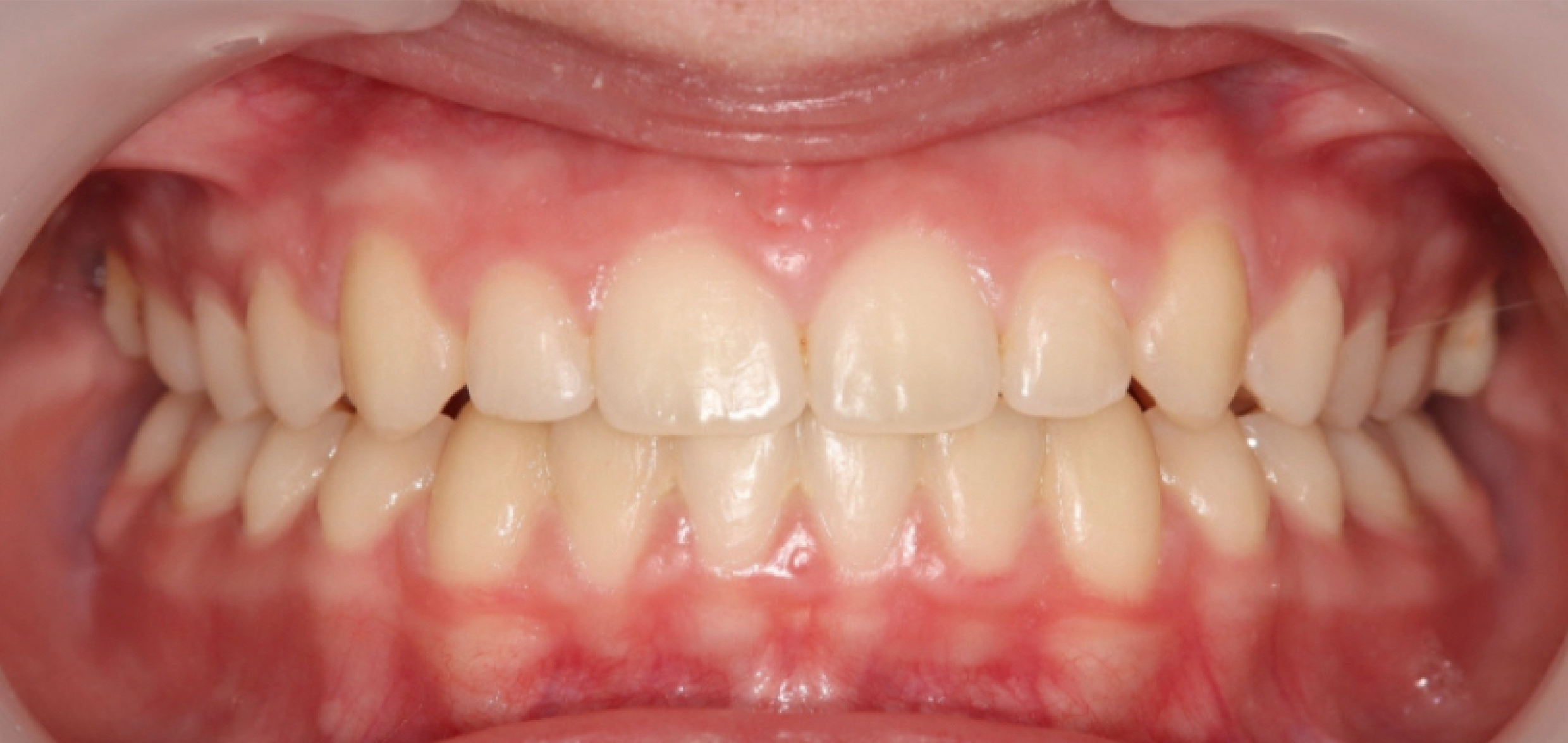 Exemples de cas traités par le Dr Quentin Boison