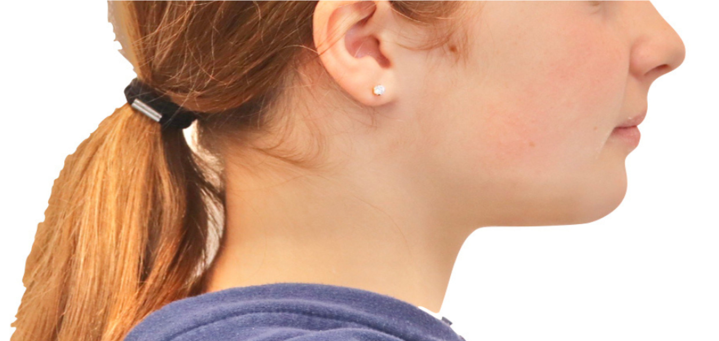 Exemples de cas traités par le Dr Quentin Boison