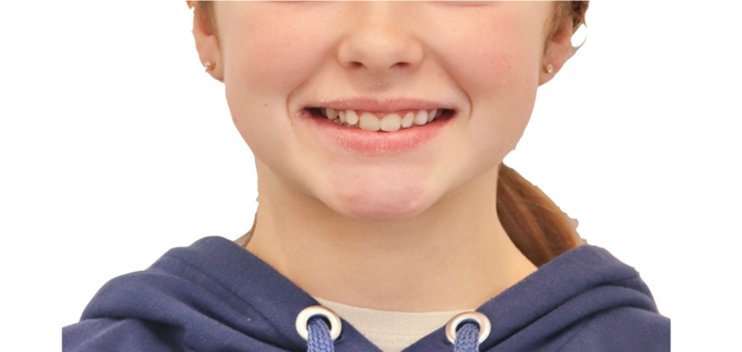 Exemples de cas traités par le Dr Quentin Boison