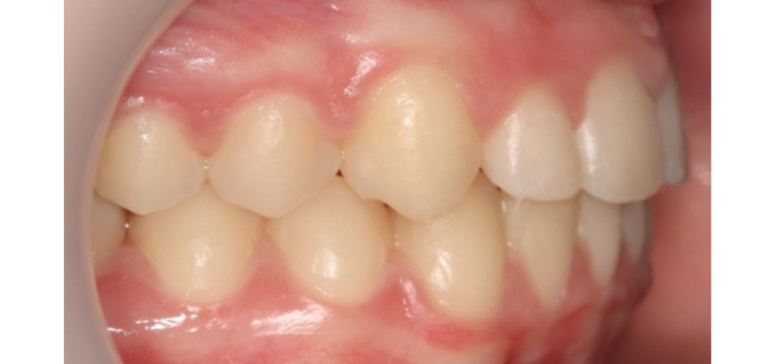 Exemples de cas traités par le Dr Quentin Boison