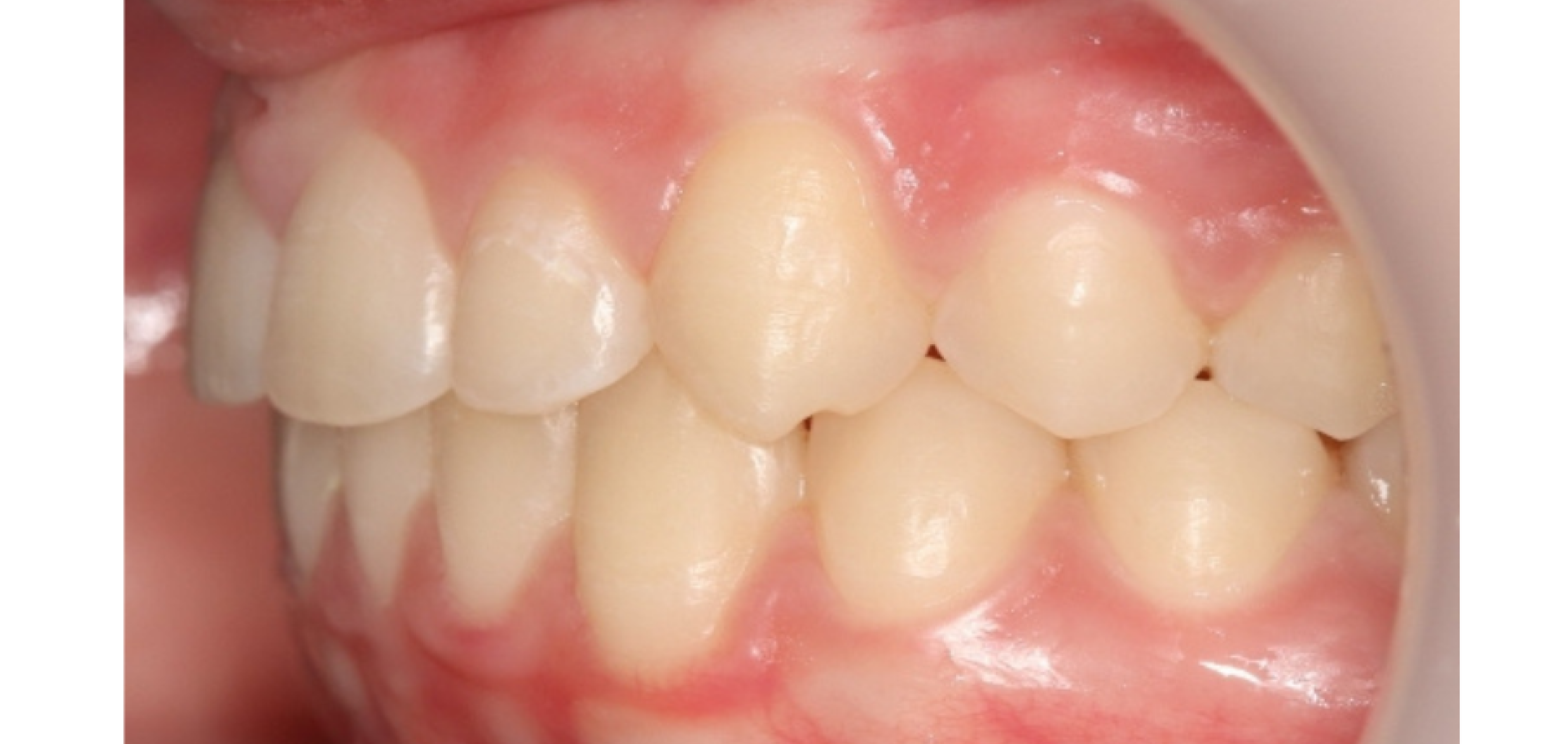 Exemples de cas traités par le Dr Quentin Boison