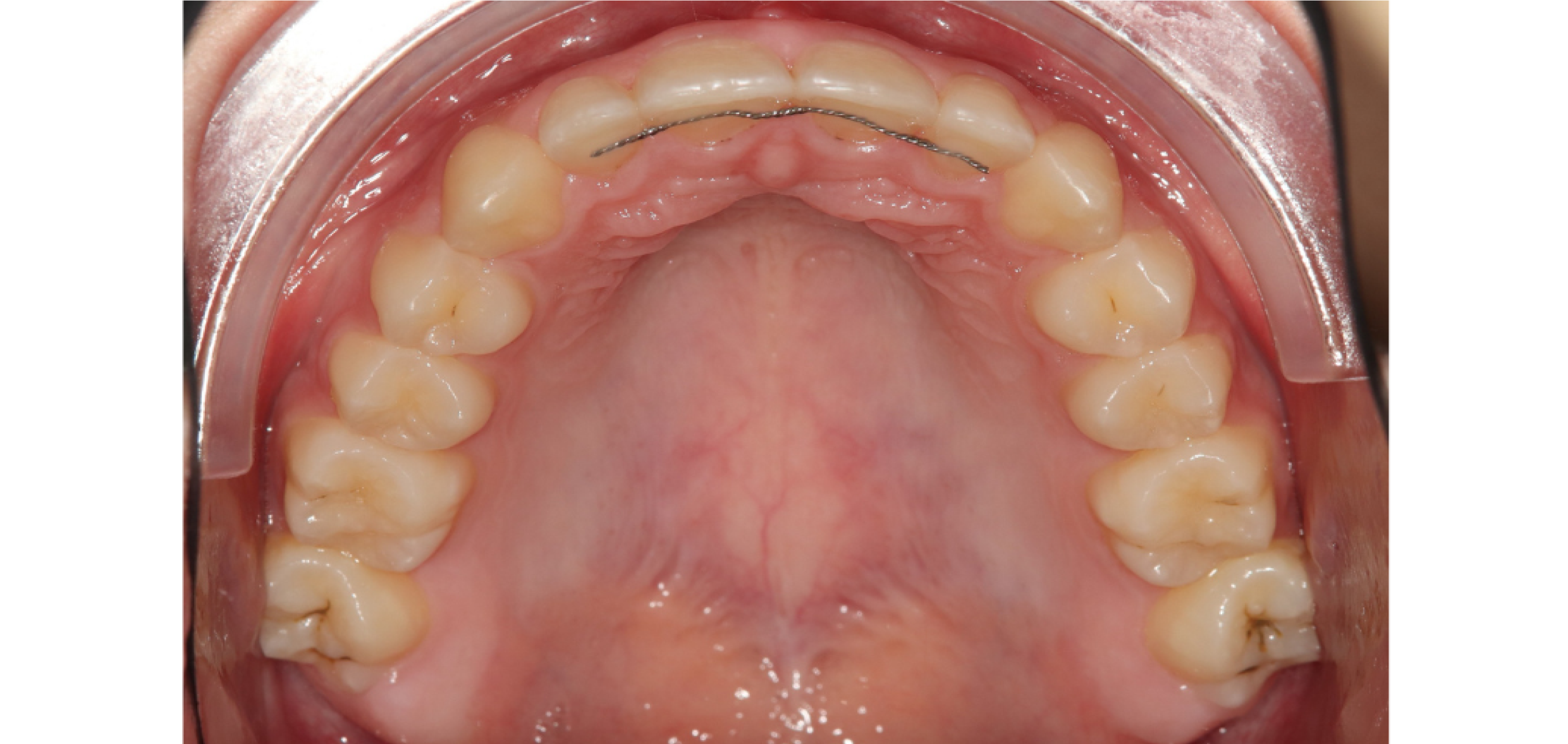 Exemples de cas traités par le Dr Quentin Boison