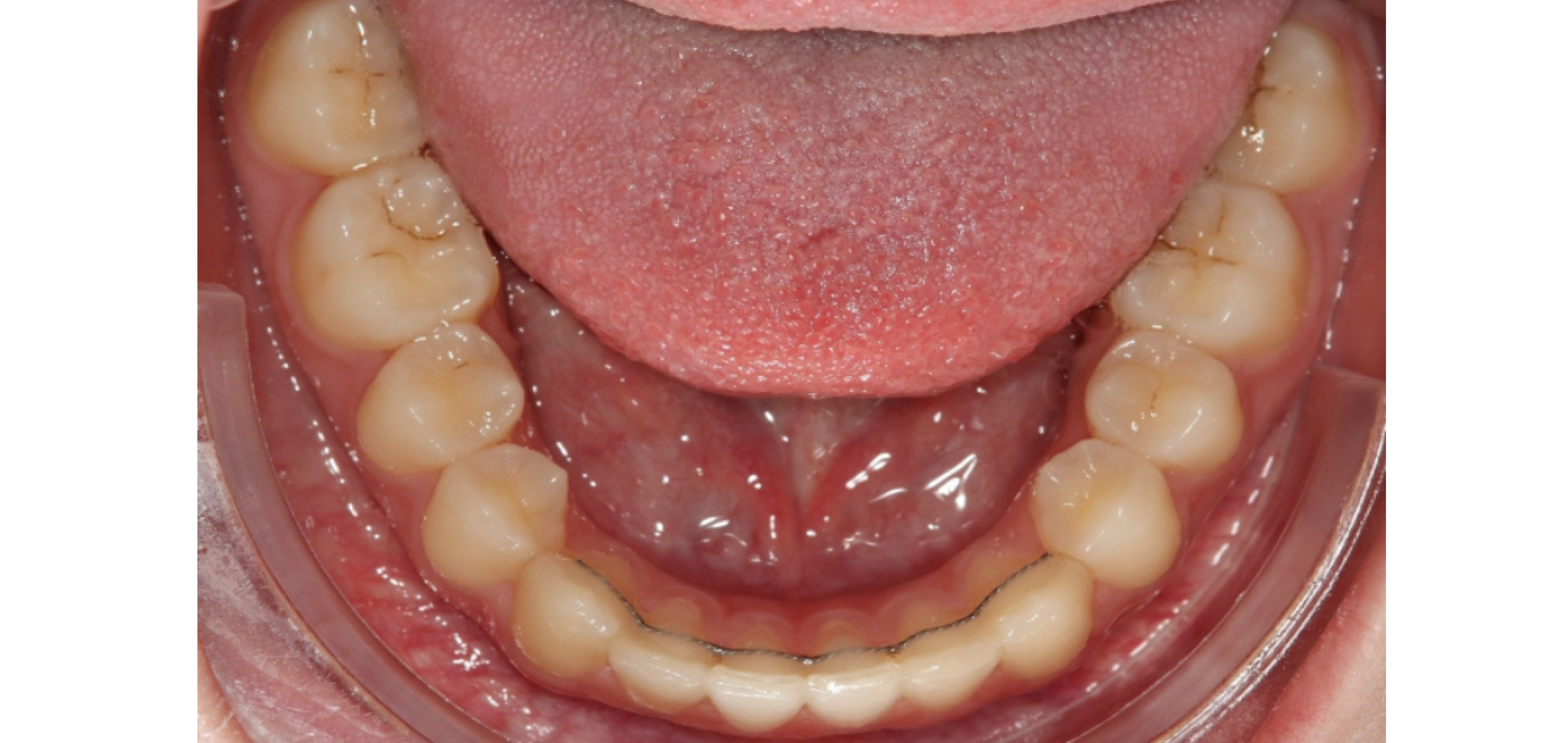 Exemples de cas traités par le Dr Quentin Boison