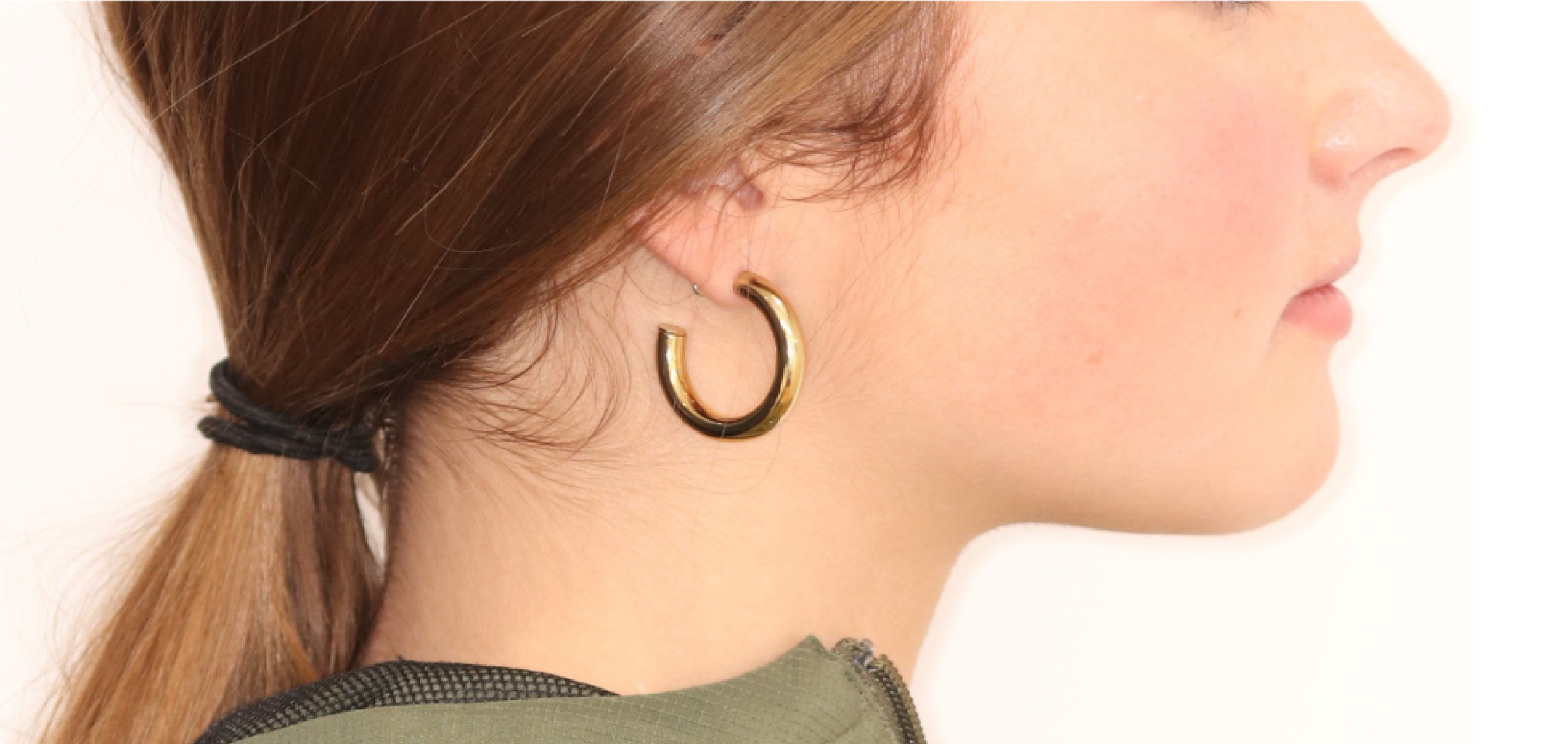 Exemples de cas traités par le Dr Quentin Boison