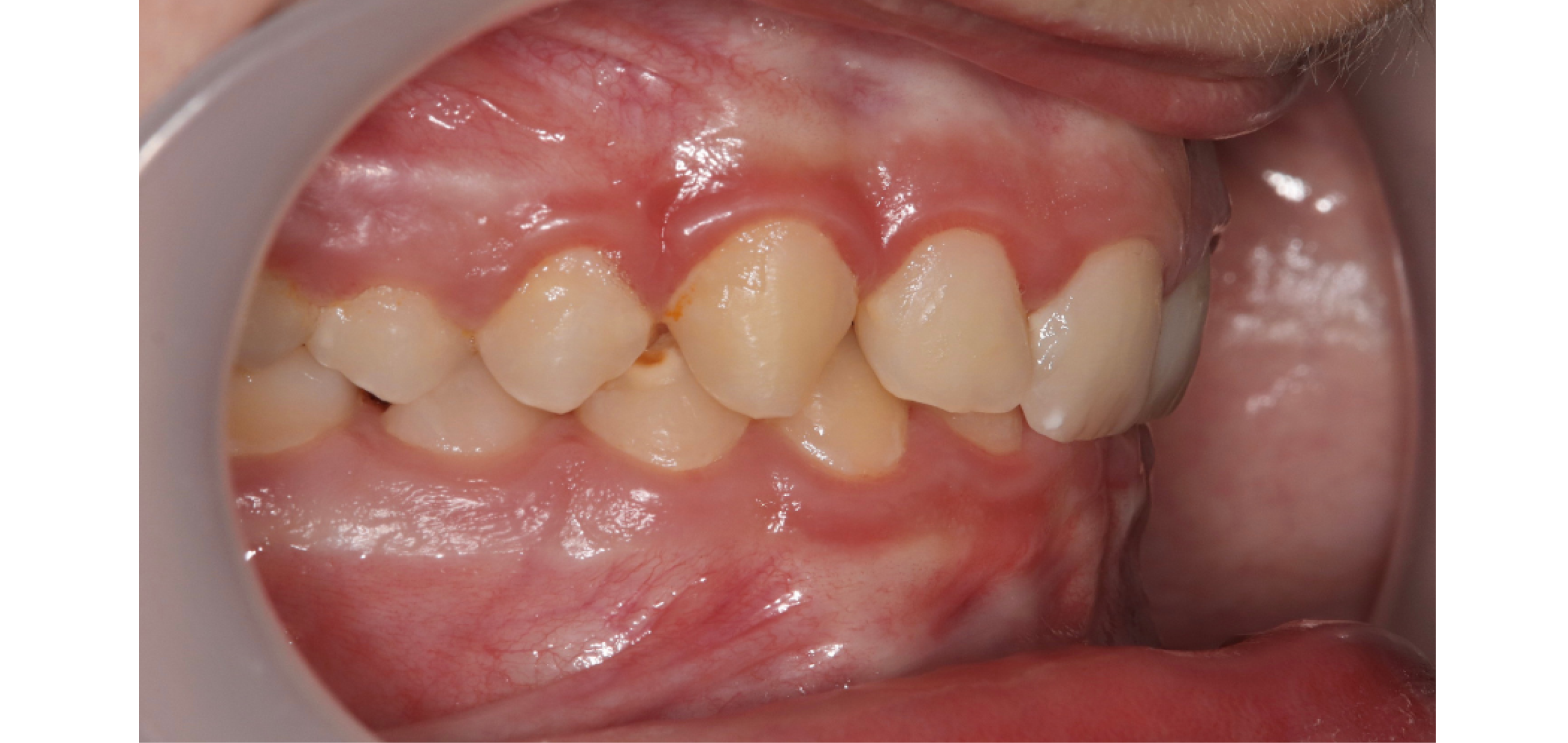 Exemples de cas traités par le Dr Quentin Boison