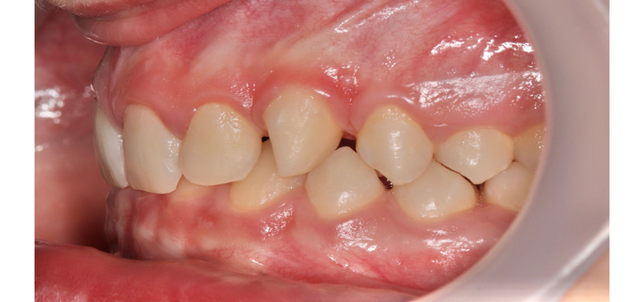 Exemples de cas traités par le Dr Quentin Boison