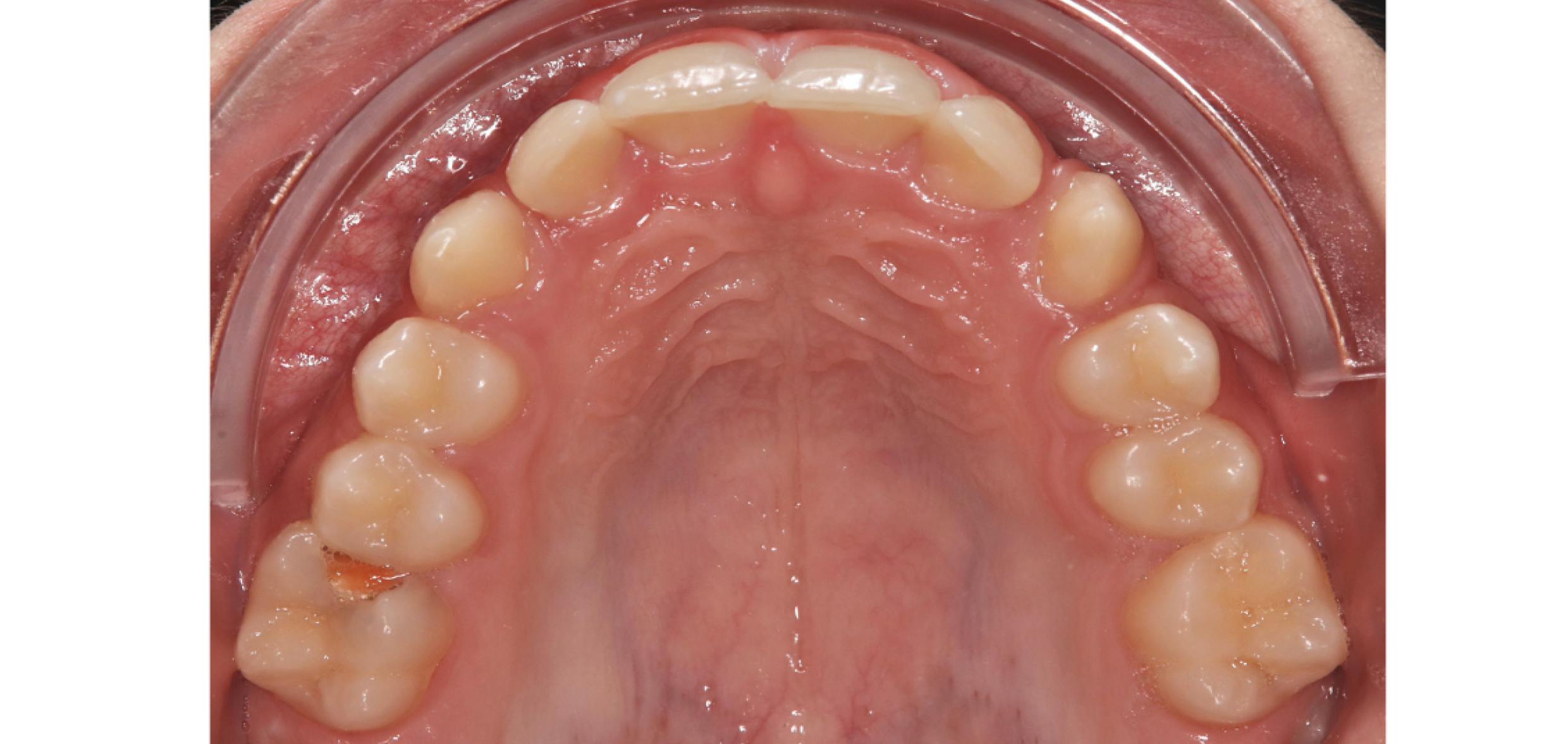 Exemples de cas traités par le Dr Quentin Boison