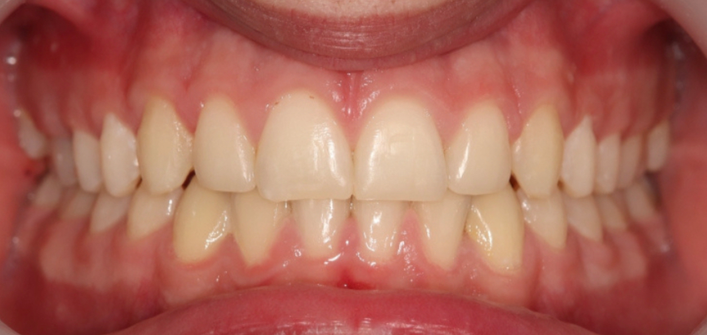 Exemples de cas traités par le Dr Quentin Boison