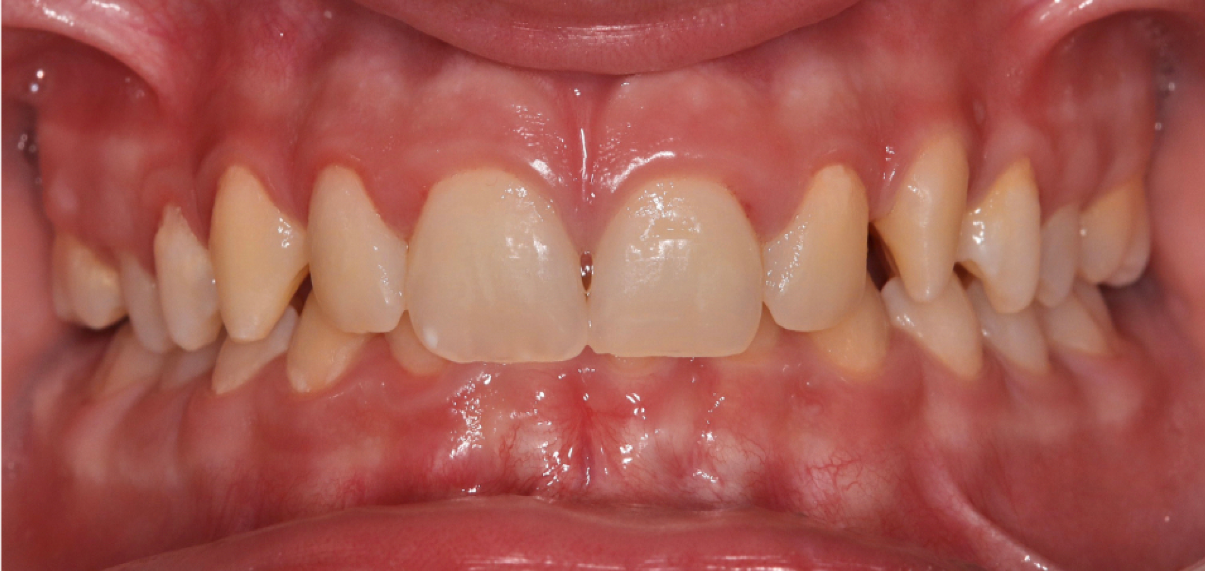 Exemples de cas traités par le Dr Quentin Boison