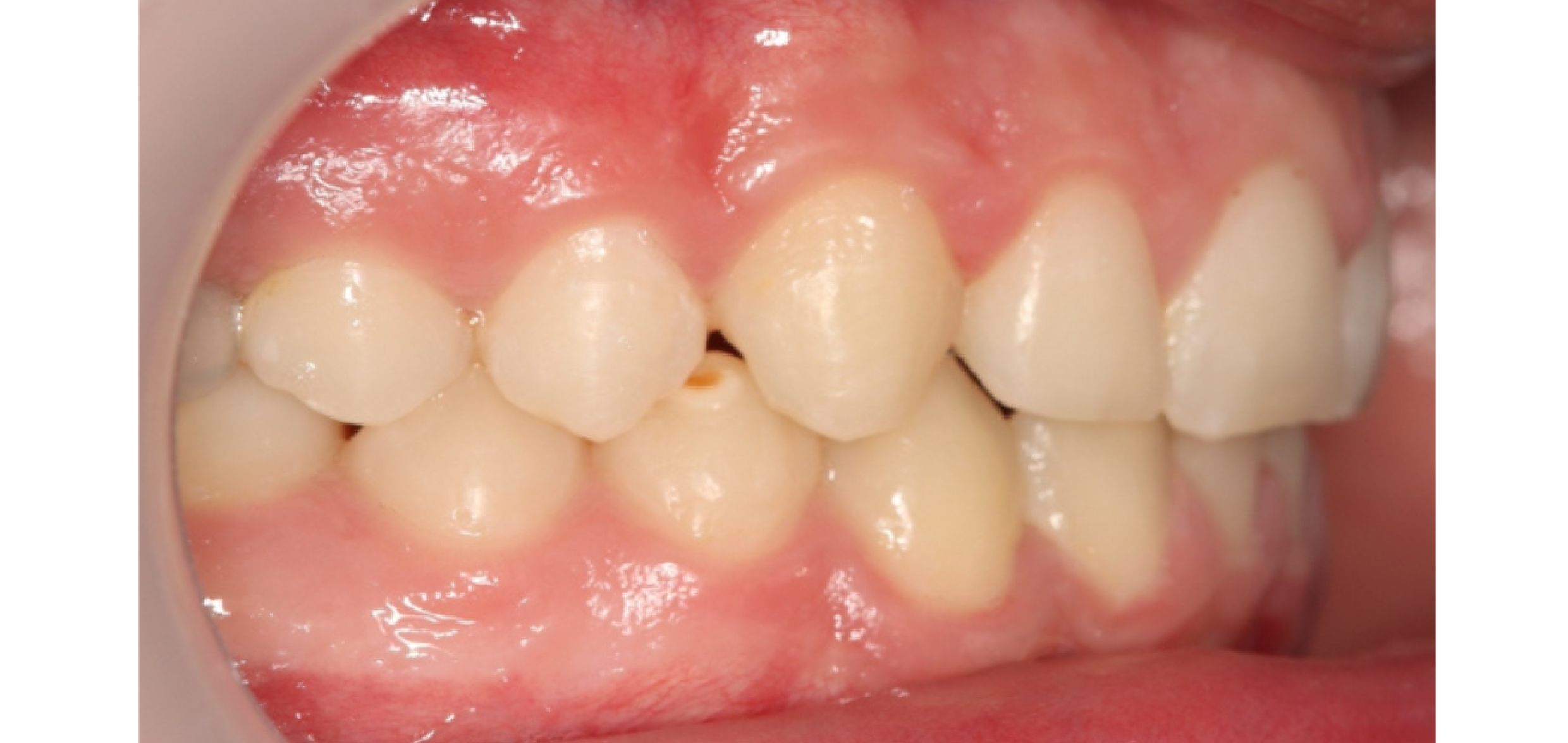 Exemples de cas traités par le Dr Quentin Boison