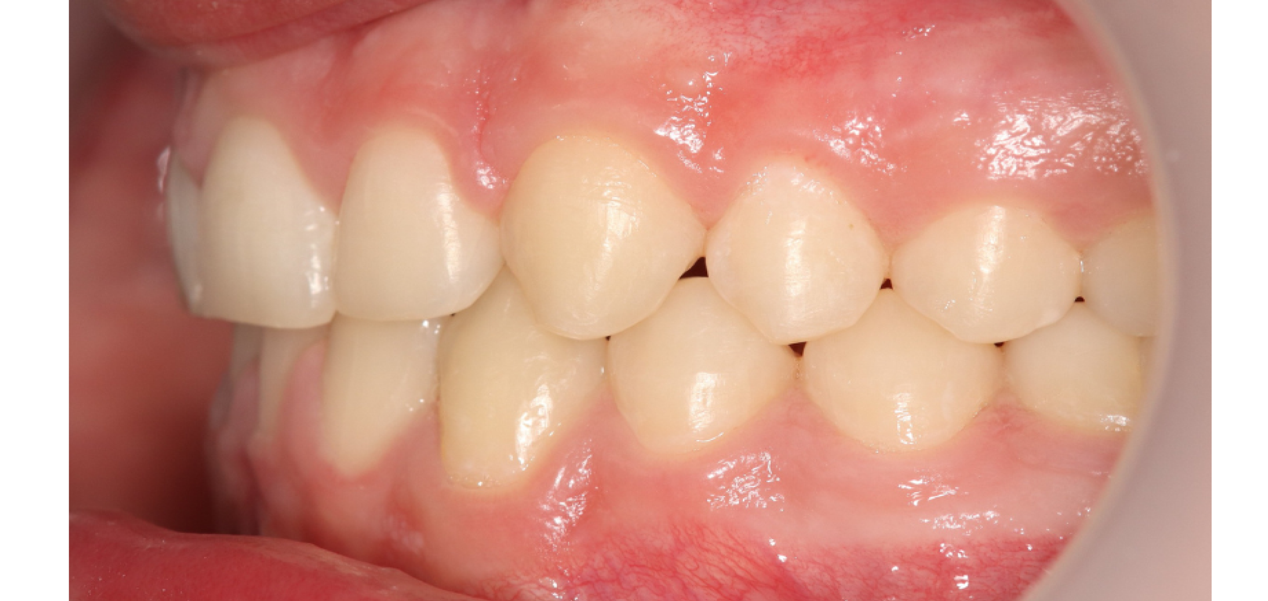 Exemples de cas traités par le Dr Quentin Boison