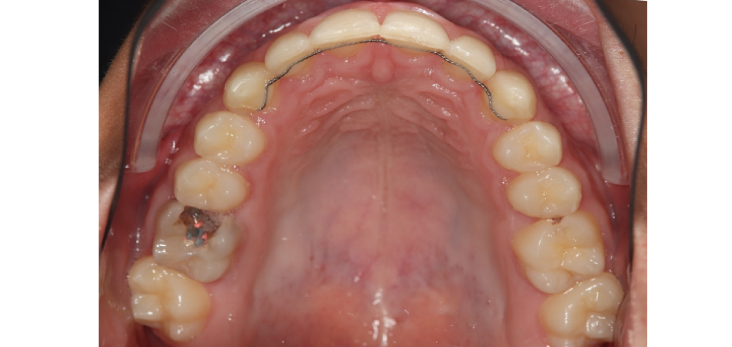 Exemples de cas traités par le Dr Quentin Boison