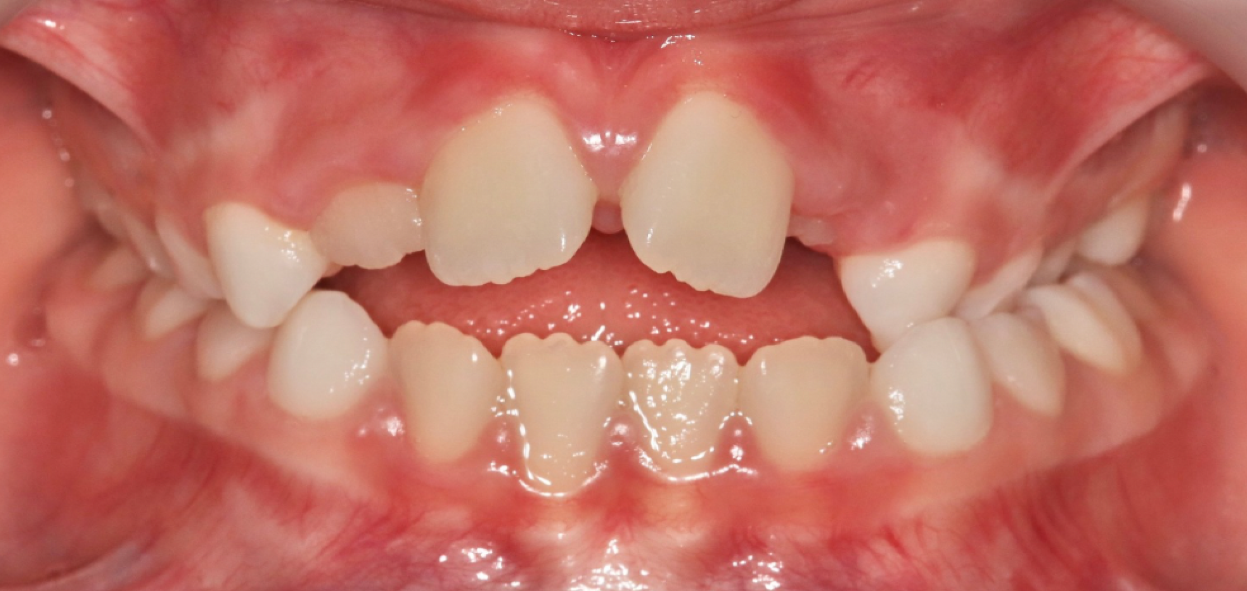 Exemples de cas traités par le Dr Quentin Boison