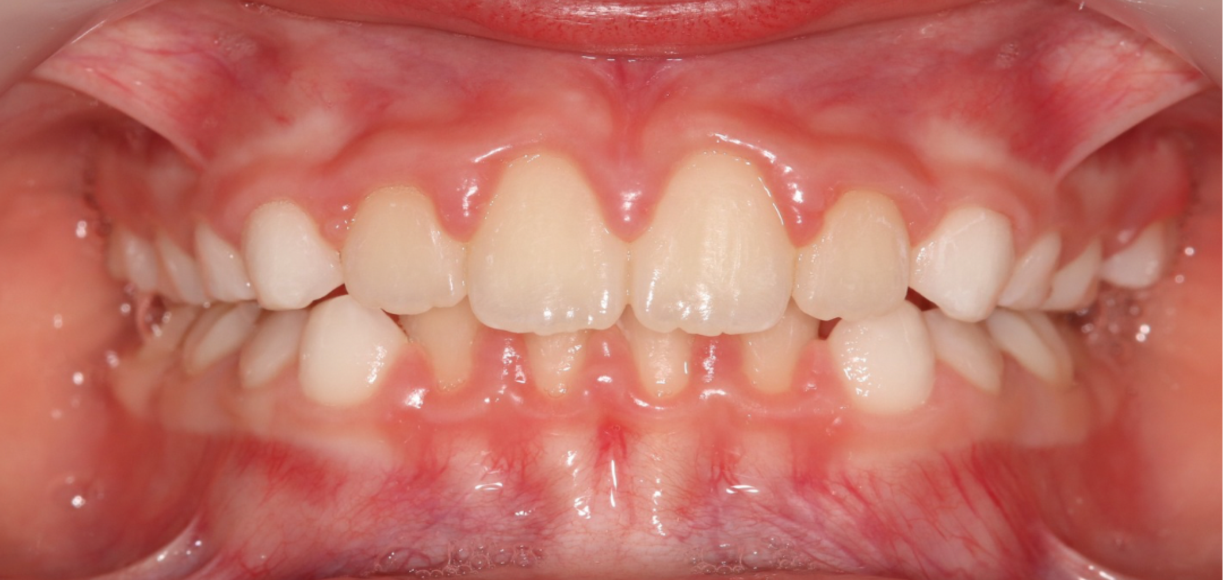Exemples de cas traités par le Dr Quentin Boison