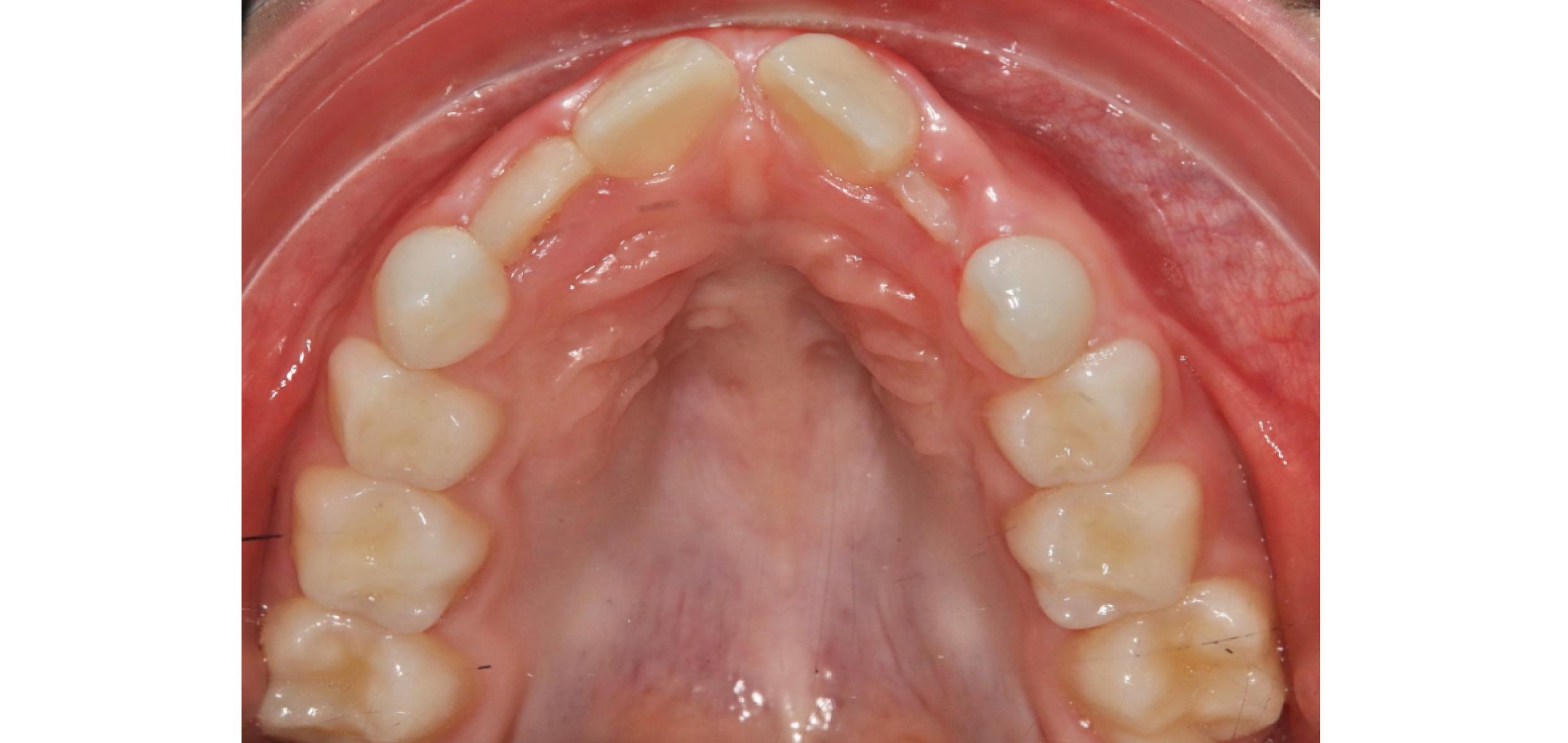 Exemples de cas traités par le Dr Quentin Boison