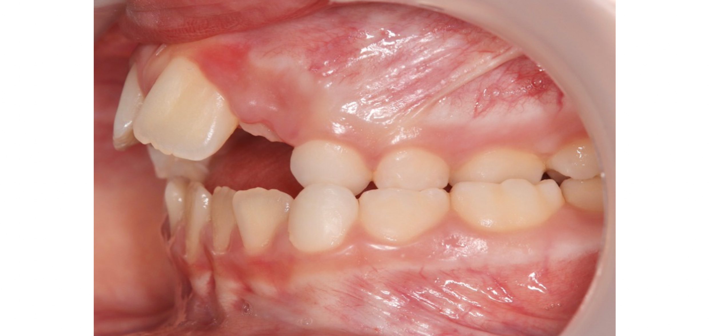 Exemples de cas traités par le Dr Quentin Boison