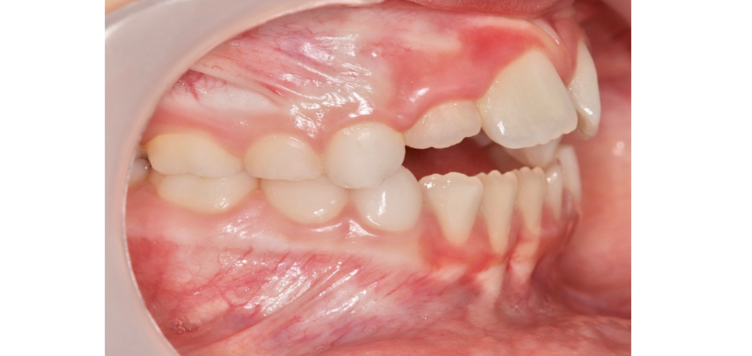 Exemples de cas traités par le Dr Quentin Boison